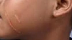 TUTURPEDIA - Dilaporkan ke Polisi, Oknum Kepala Sekolah di Blora Bantah Mencakar!