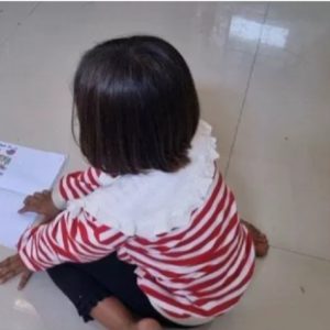 Imbas Mata Ditusuk Hingga Alami Kebutaan, Keluarga Siswi SD di Gresik Minta Keadilan