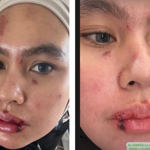Viral! Tanggapi Soal Penyakit Misterius Kartika Putri, Richard Lee: Mudah-mudahan Bukan Azab