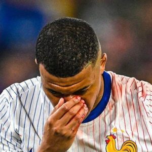 Hidung Patah hingga Bersimbah Darah, Mbappe Terancam Absen Lawan Belanda