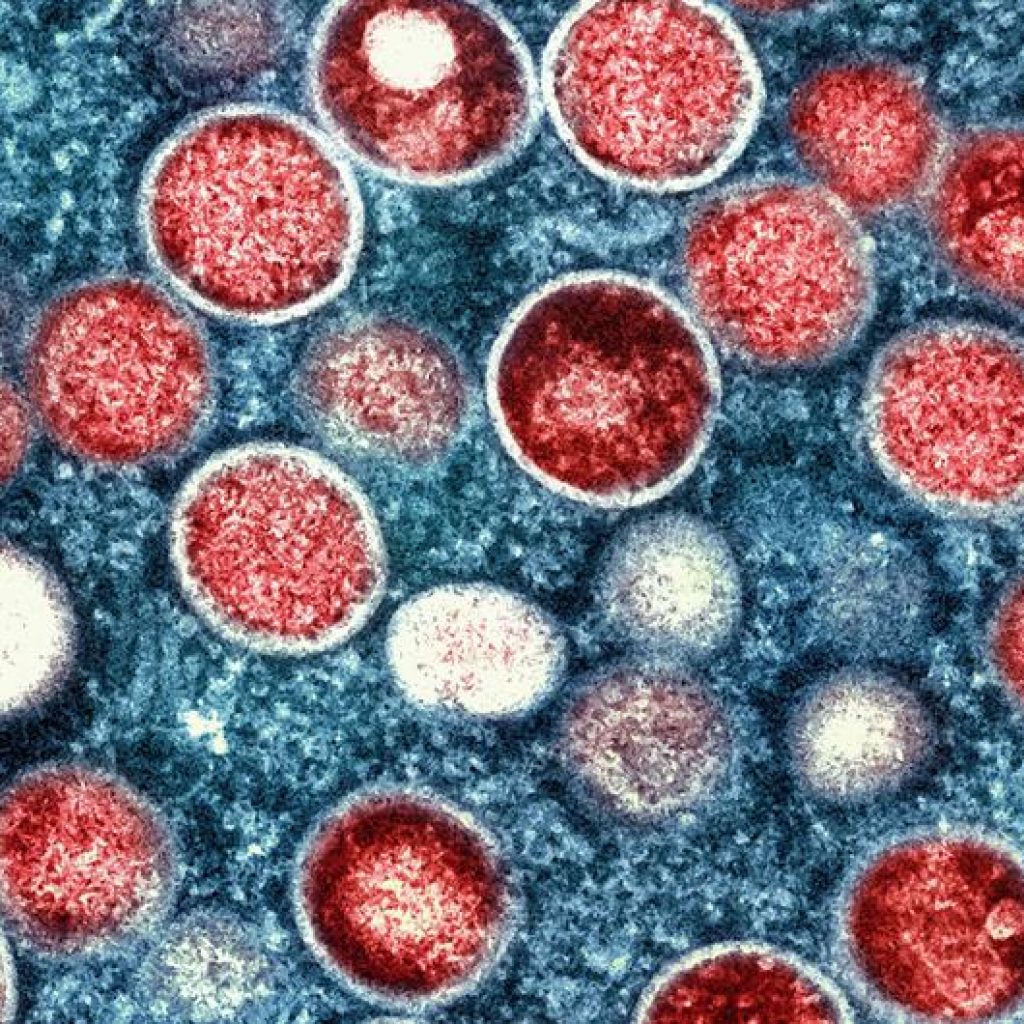 WHO adakan pertemuan darurat setelah angka Mpox meningkat tajam di Afrika. Foto: news.un.org