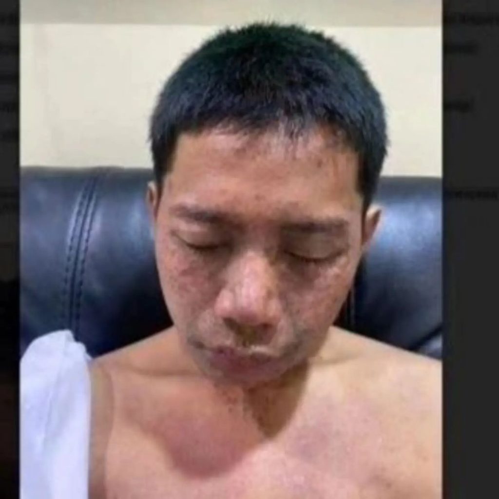 Viral Video Pelajar Disiram Air Keras Oleh Sesama Pelajar Saat Menaiki Motor di Jaktim 