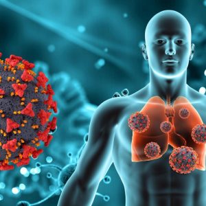 Kasus TBC Tahun 2023 Meningkat hingga 800 Ribu Kasus! Ini Sebabnya