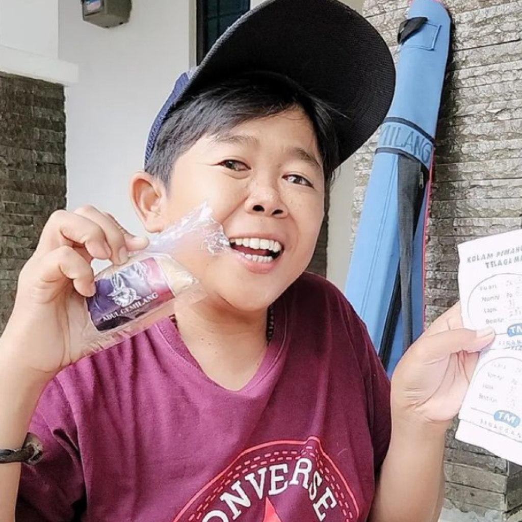 Bukan Glaukoma, Ternyata Adul Punya Masalah Ini di Bagian Mata hingga Disarankan Operasi