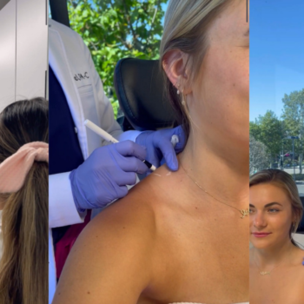 Wanita Amerika beramai-ramai melakukan Barbie Botox, kenali efek sampingnya pada tubuh. Foto: Tangkapan layar Youtube Short @aestheticmdr8367