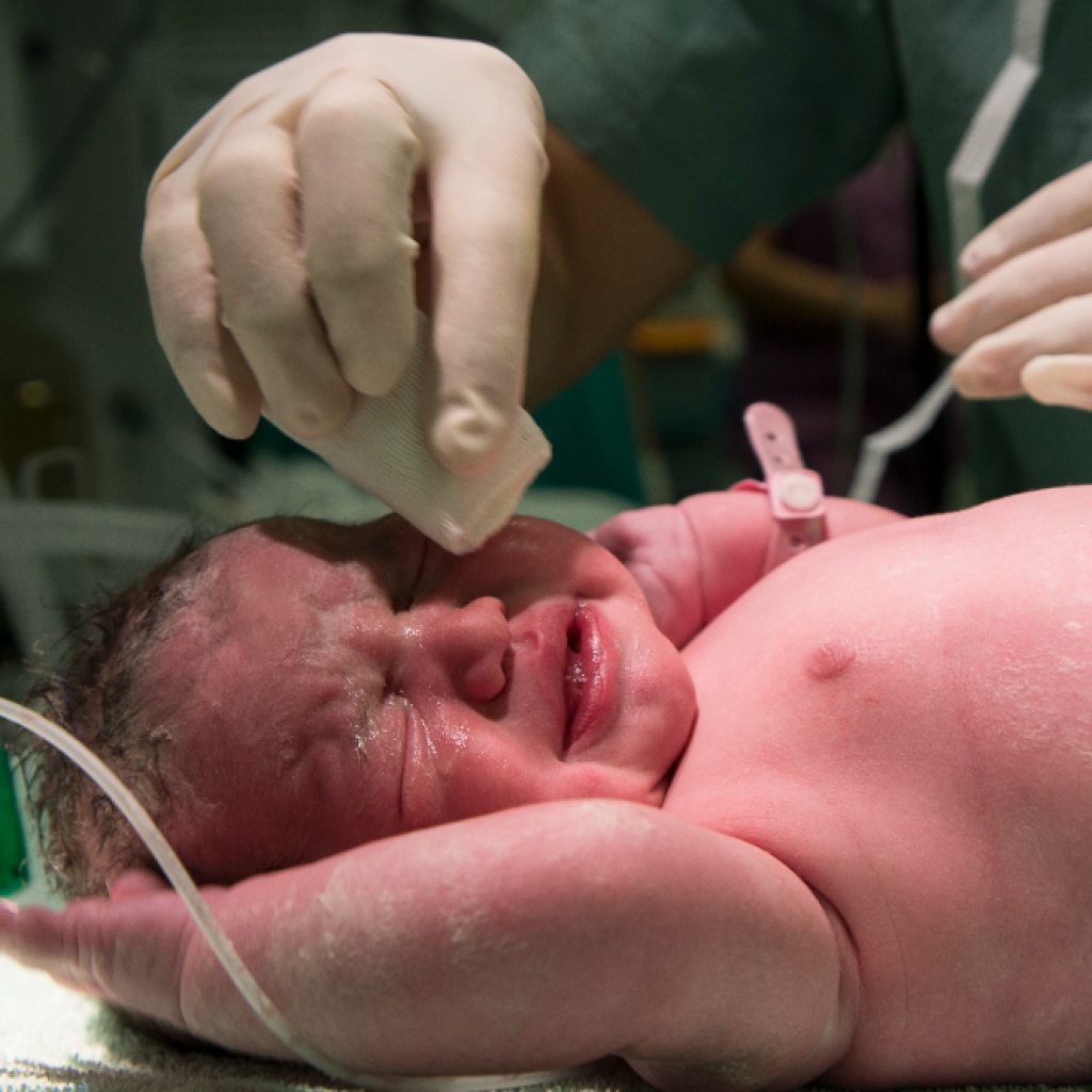 Pemahaman tentang metode melahirkan water birth. Foto: freepik.com
