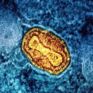 Minimalkan Persebaran Mpox, Pemerintah Indonesia Pasang Thermal Scanner hingga Aplikasi Satusehat di Bandara