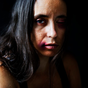 Sadis! Pria di Langkat Bakar Istri Hidup-Hidup, Akibatkan Luka Bakar dari Wajah hingga Paha